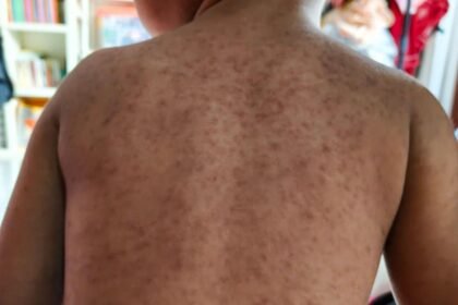 01b9f430-0b27-11f1-a204-b3f033b84443