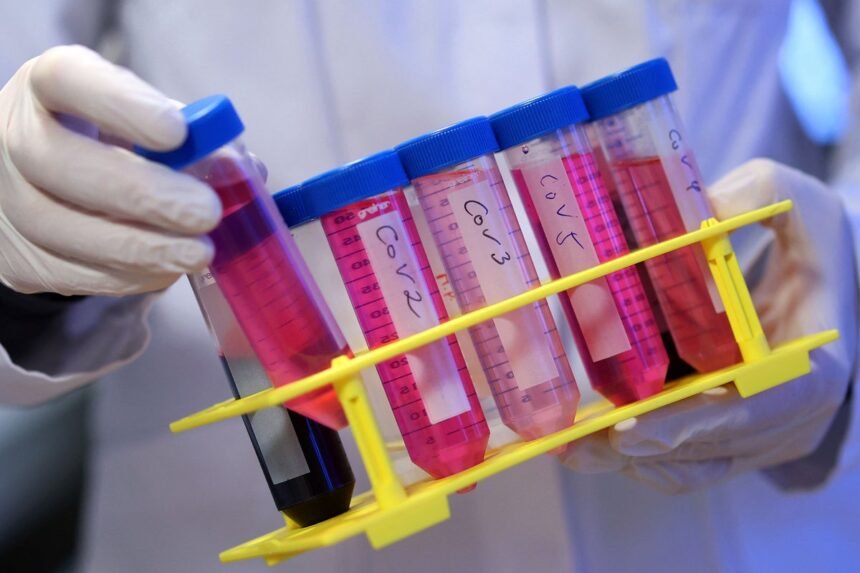 Test-tubes-with-Covid-19-cell-cultures-during-a-long-covid-sample-processing