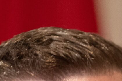 Y7YQ4YDH7RHYVOE5DDWZ7IGFKU-5