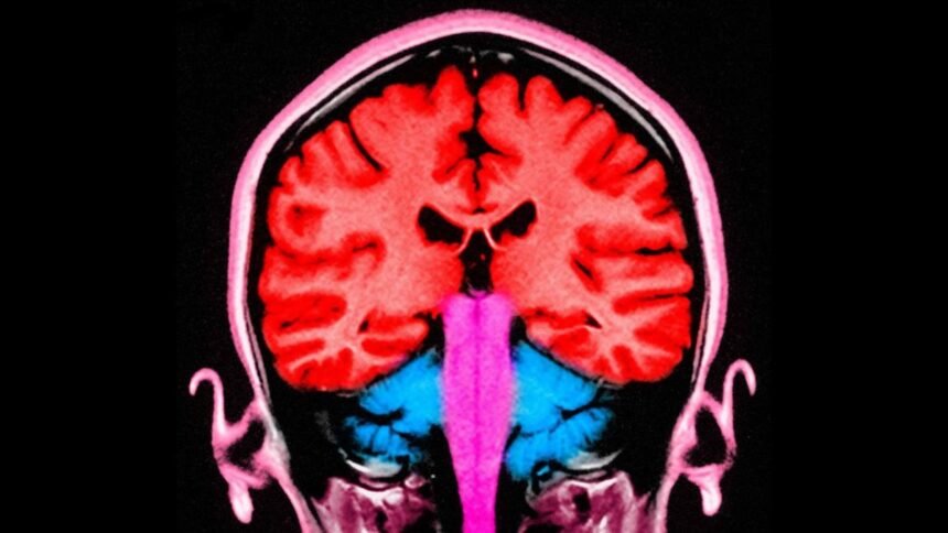 f1e86890-081d-11f1-8fdd-d9a354700c27