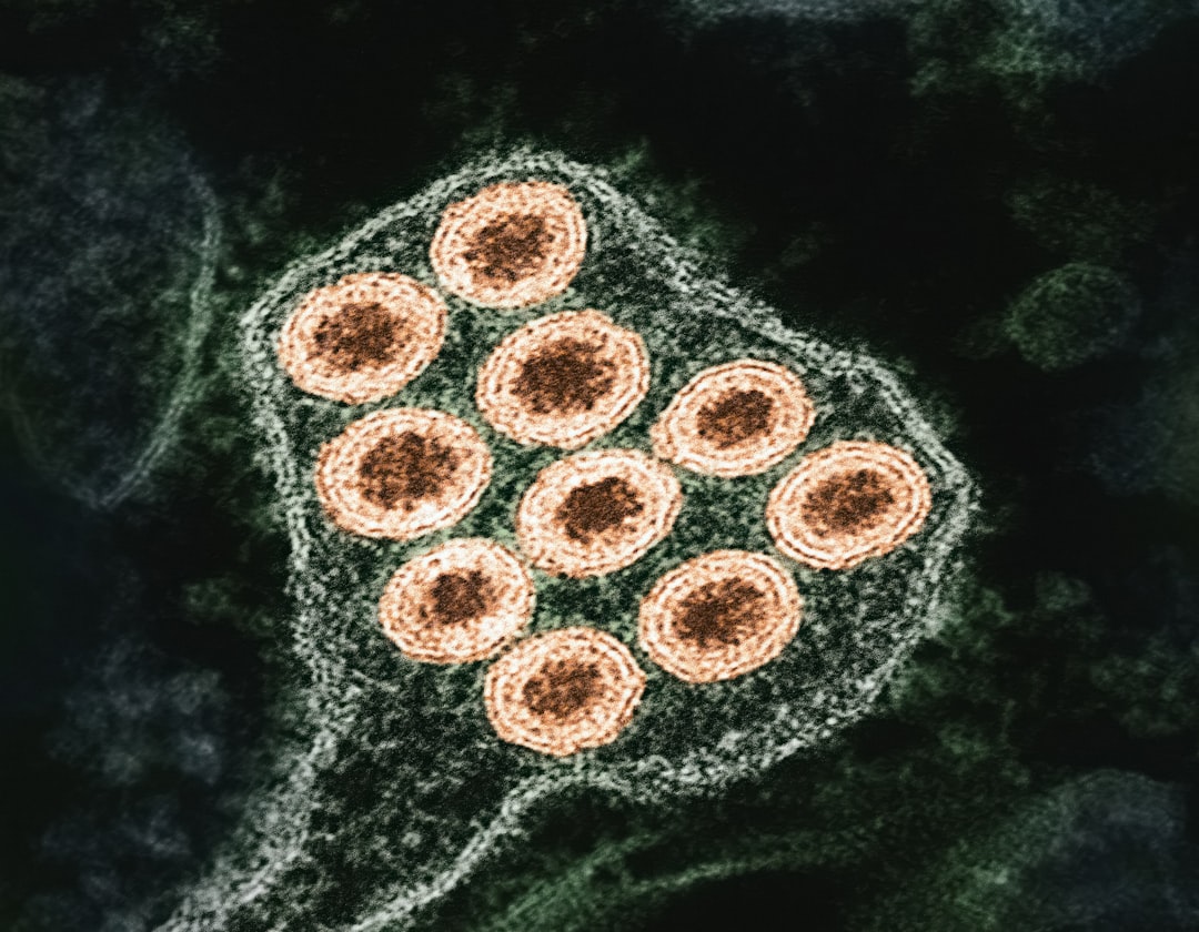 Recognising the Symptoms of Measles