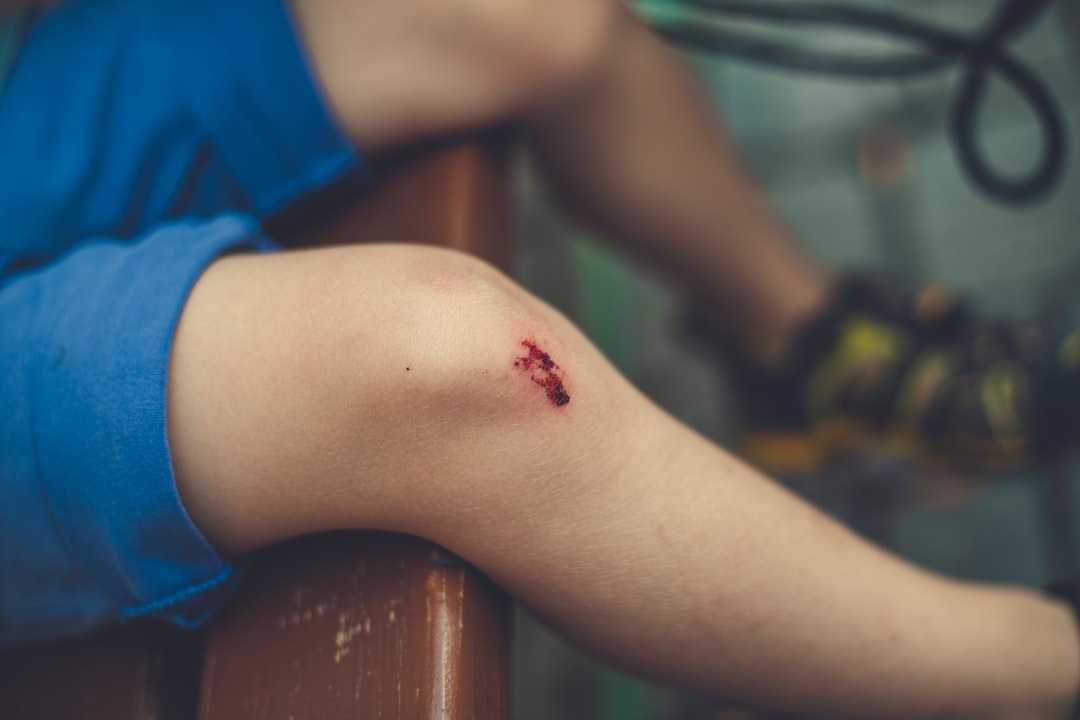 Injury Updates and Upcoming Challenges