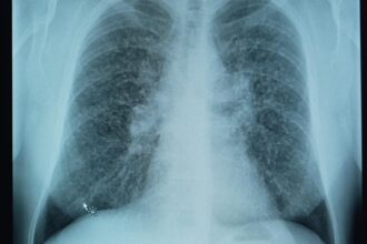 skynews-silicosis-kitchens_7244384