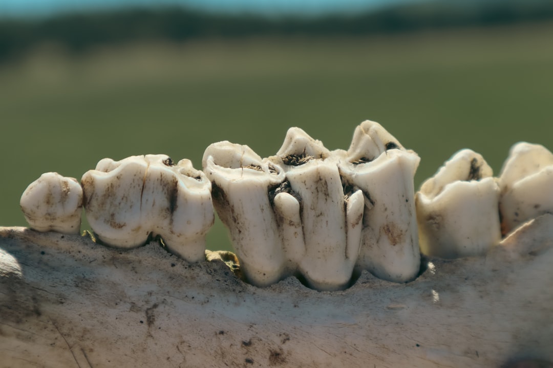 Recommendations for Maintaining Bone Health