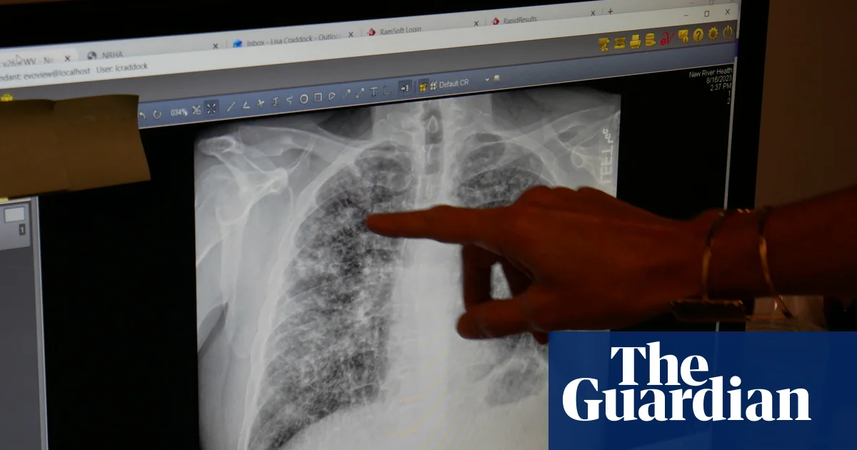 Industry Pushback Against Protections