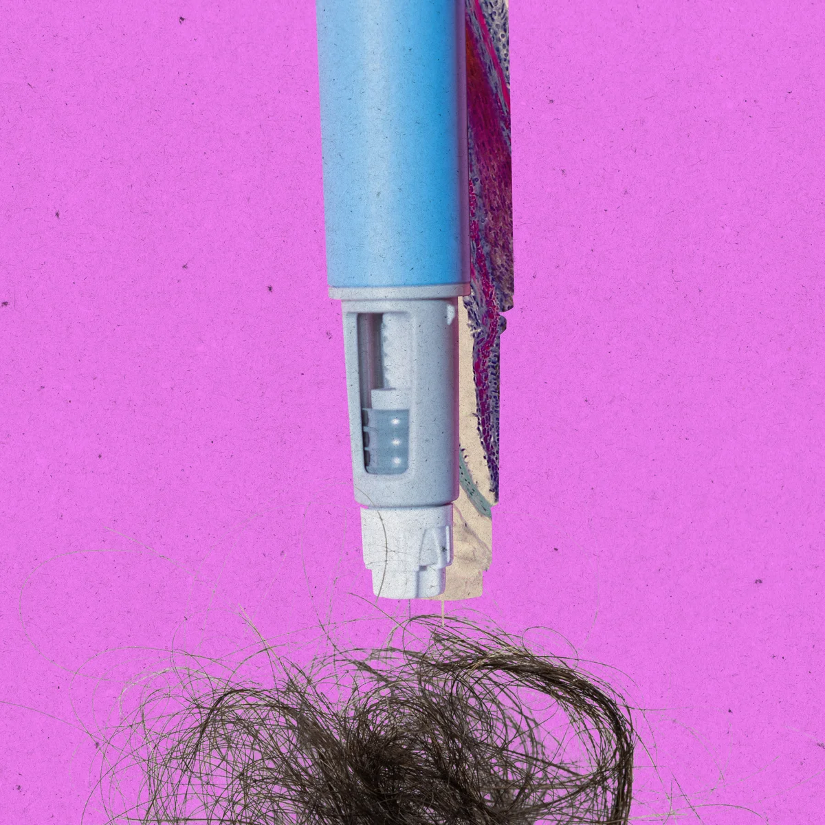 Managing and Mitigating Hair Loss