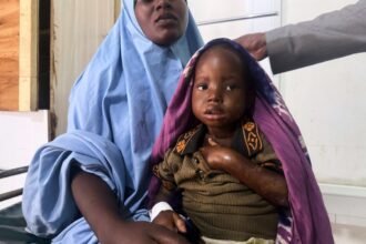 Somalia_Malnutrition_3_938